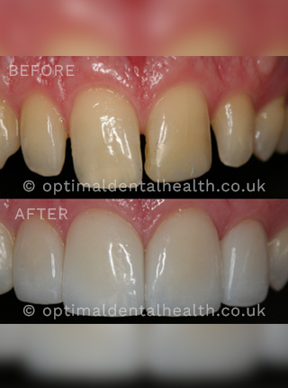 before&after