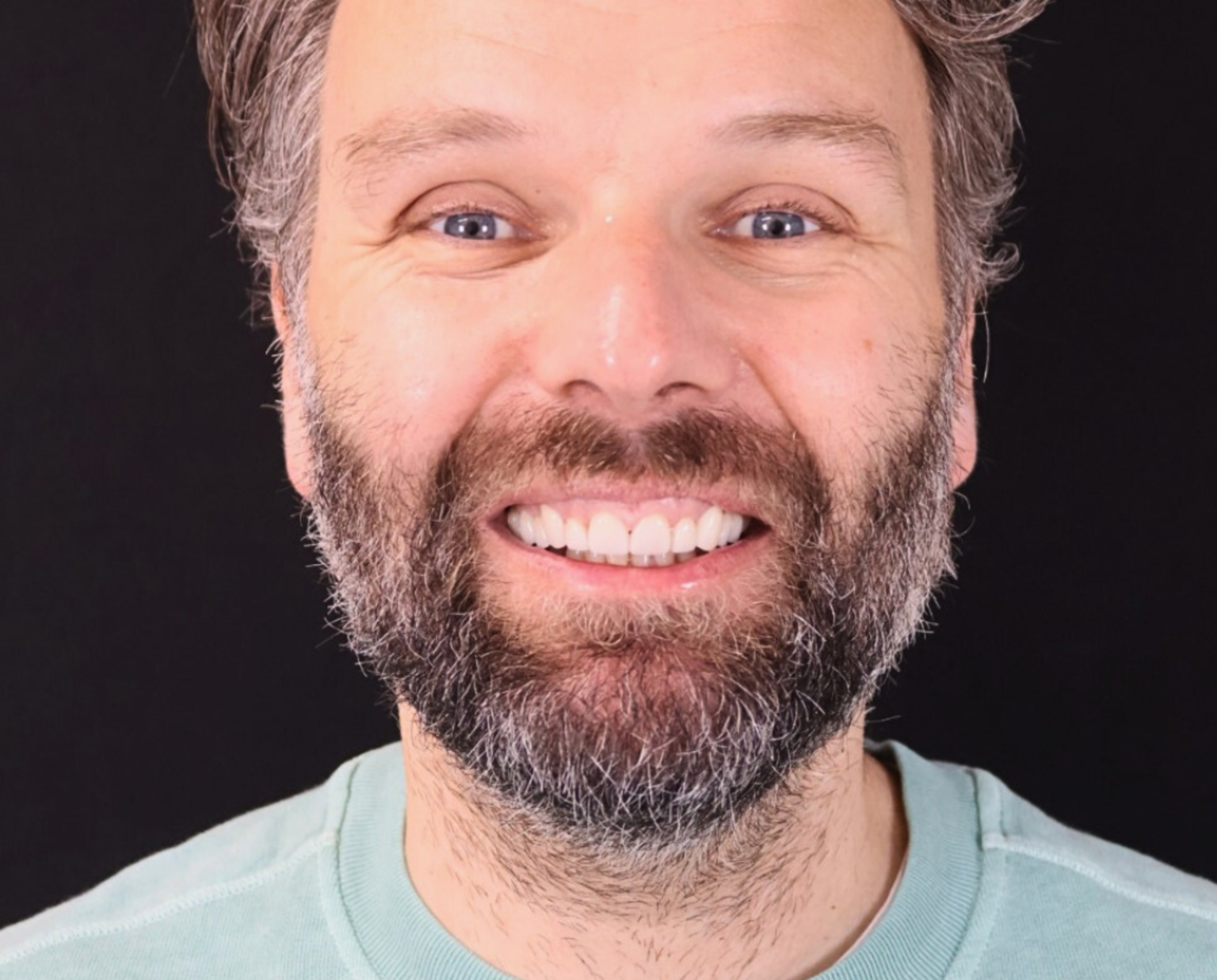 Optimal Dental Health: Porcelain Veneers | London Dentist