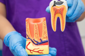 a close up of a 3D model of the inside of a tooth held by a dentist wearing blue gloves and purple scrubs in london
