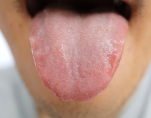 a close up image of a healthy tongue