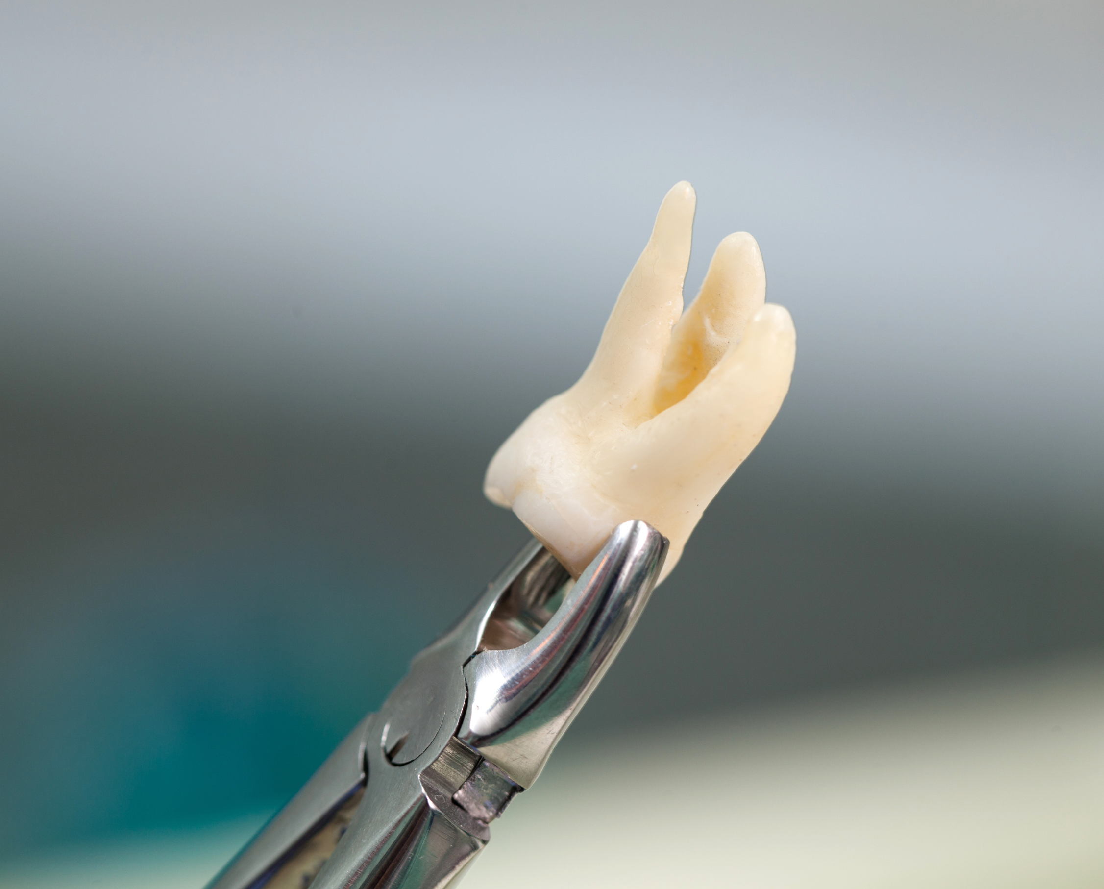 a close up image of a wisdom tooth after removal